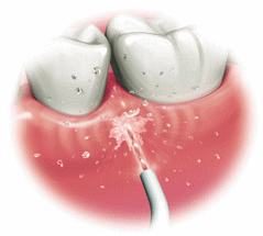 ���C�����ɂ̓h���c�W�F�b�g�E�H�b�V���[